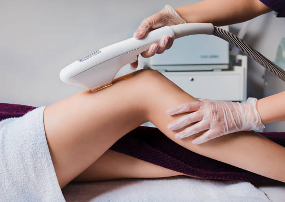 Лазерная эпиляция фото