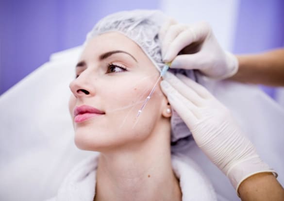 Контурная пластика лица нитями (армирование) фото